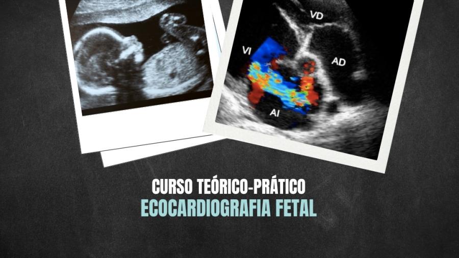 CURSO TEÓRICO-PRÁTICO ECOCARDIOGRAFIA FETAL